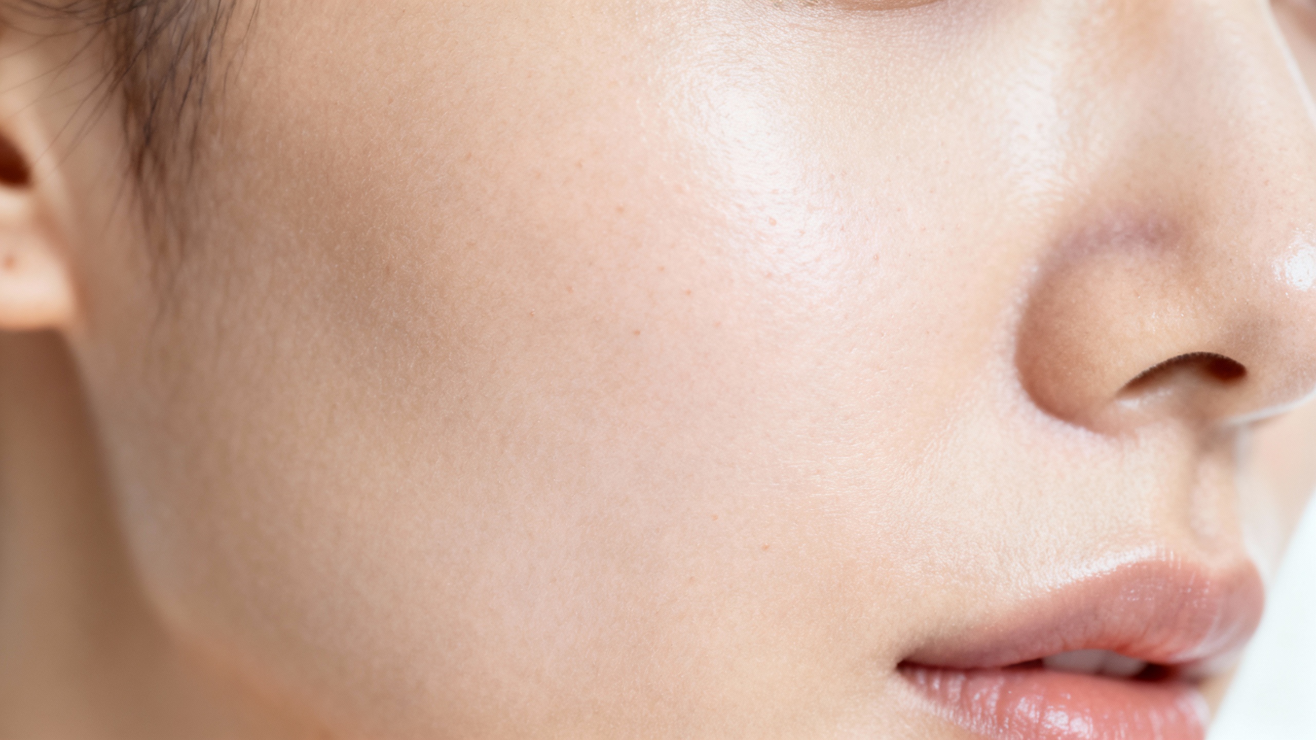 Featured image for What causes acne scars?